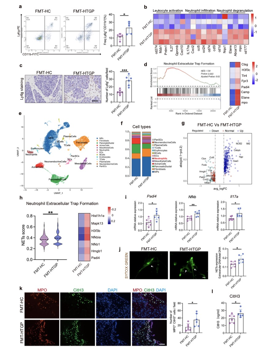高甘油三酯血症性胰腺炎的作用机制