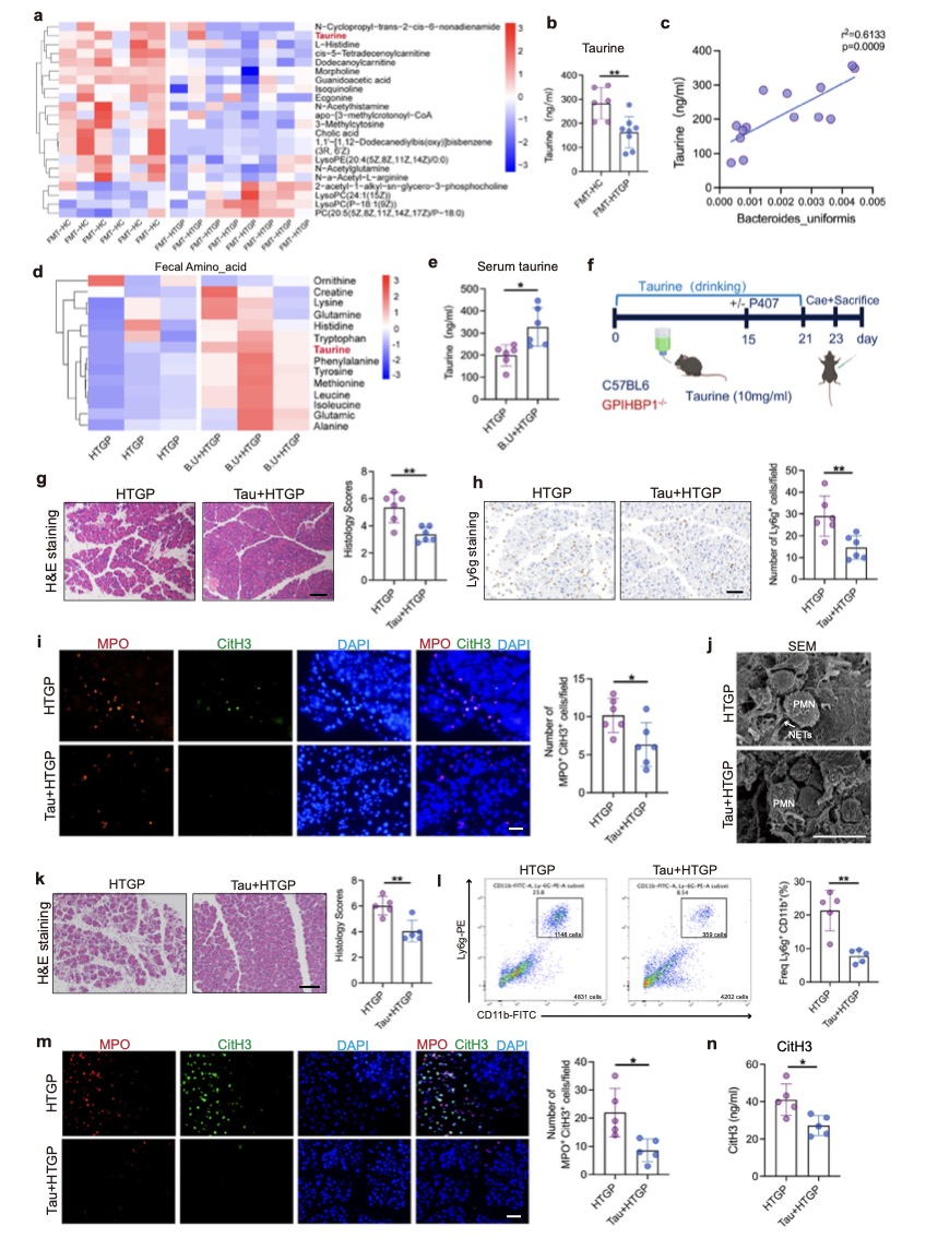 高甘油三酯血症性胰腺炎的作用机制