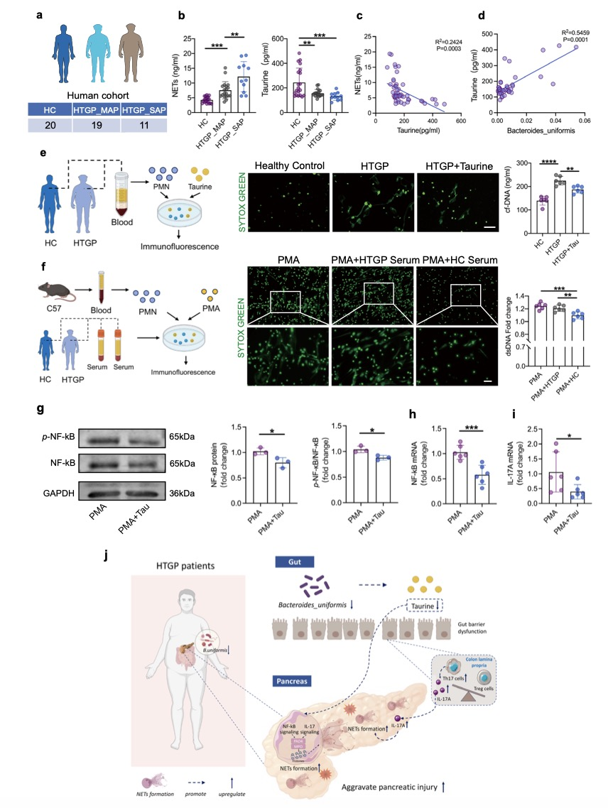 肠道菌群在高甘油三酯血症性胰腺炎的作用机制
