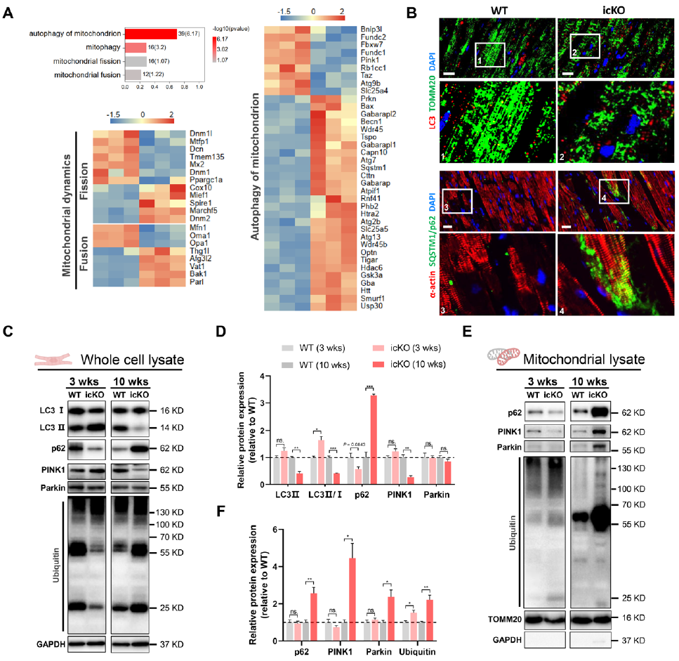 心肌病的致病新机制