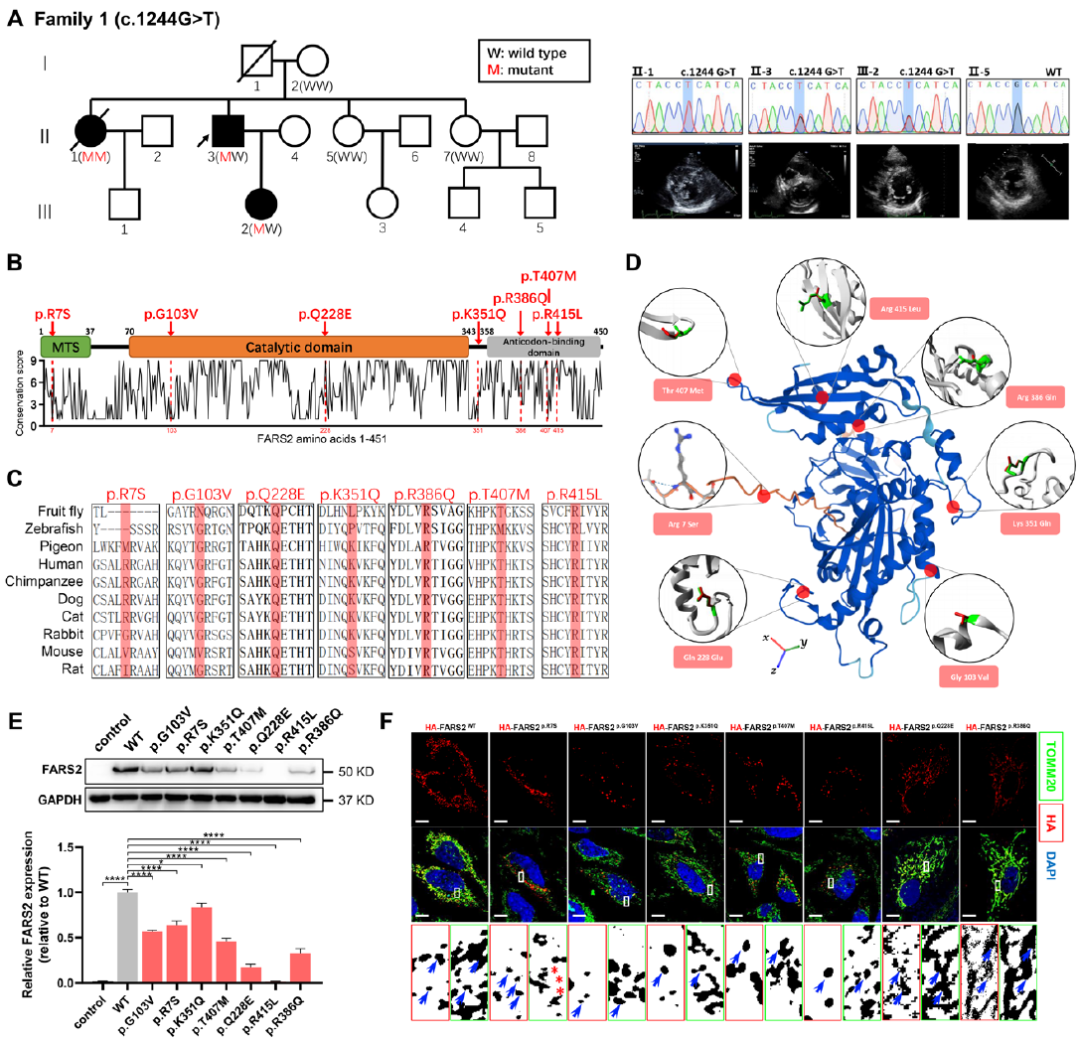 心肌病的致病新机制