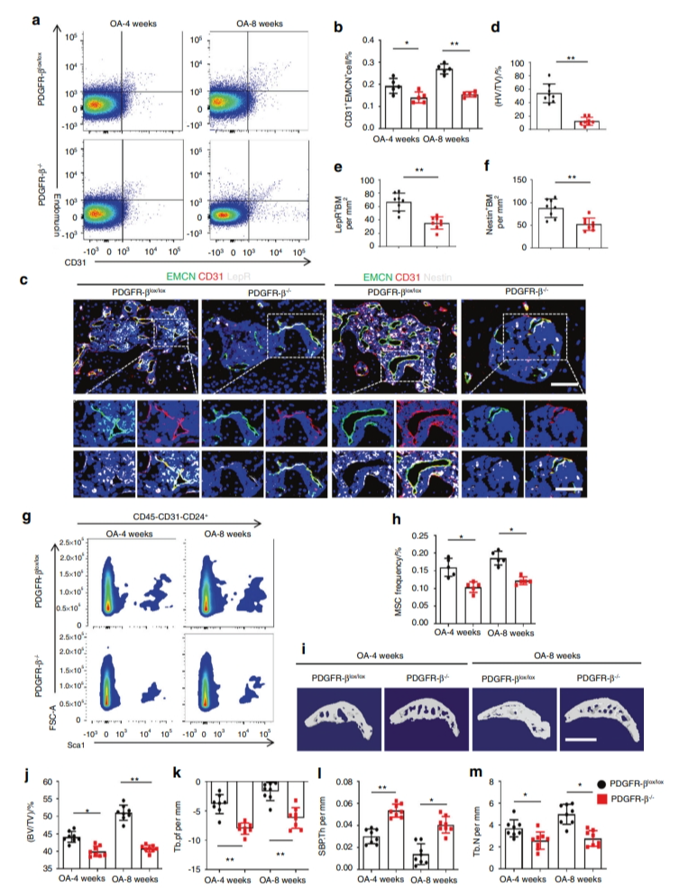 PDGFR-β通过增加依赖于H型血管的异常软骨下骨生成促进骨关节炎