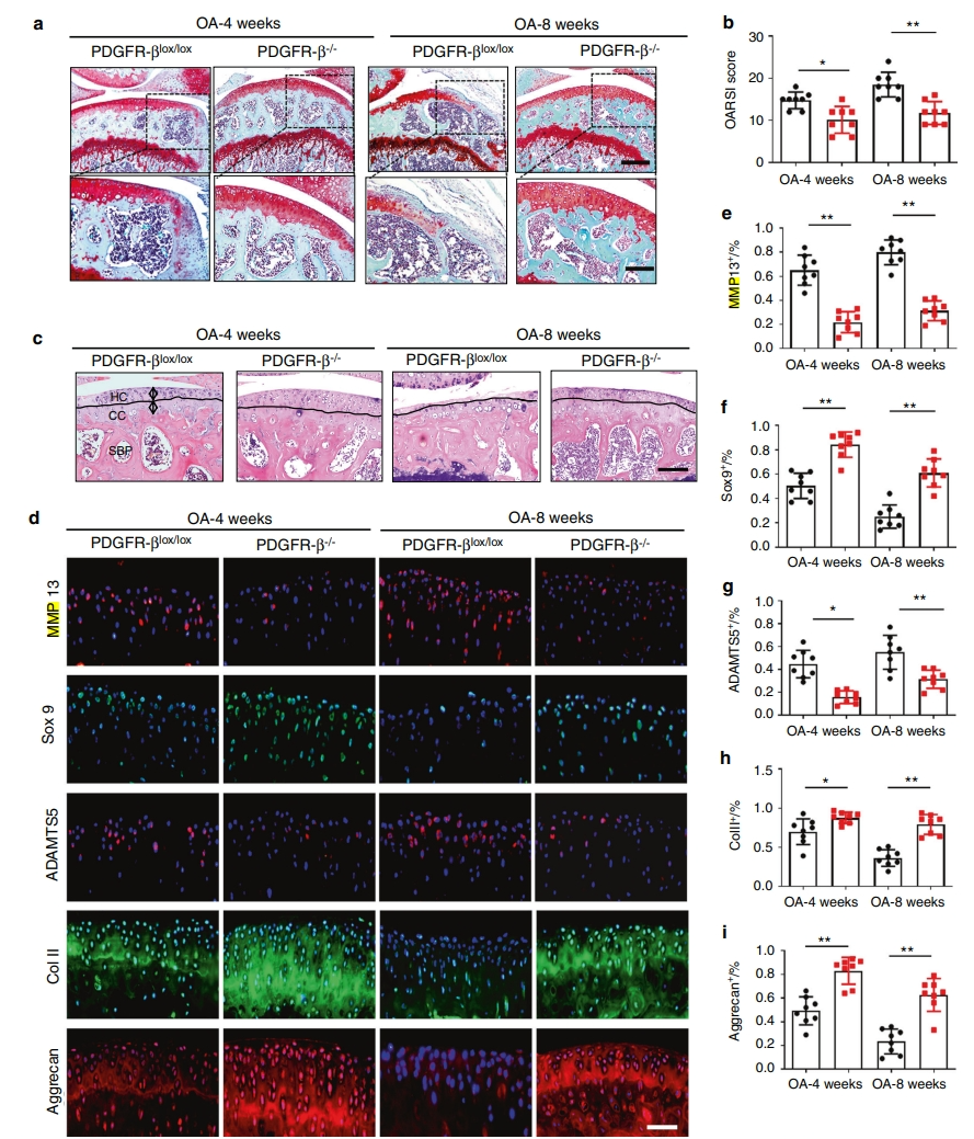 PDGFR-β通过增加依赖于H型血管的异常软骨下骨生成促进骨关节炎