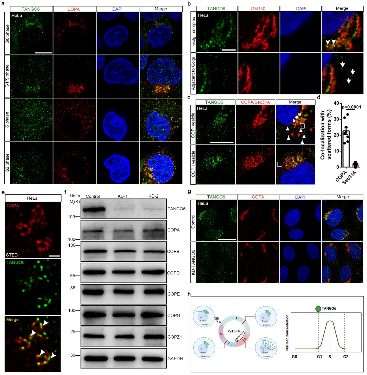 李礼/罗凌飞组合作揭示Tango6调控造血干细胞扩增的分子机制