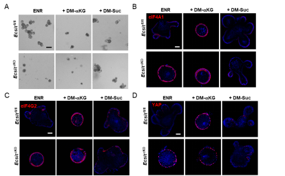  南京医科大学团队首次揭示了肠道上皮发育关键调节因子YAP蛋白翻译表达调控机制