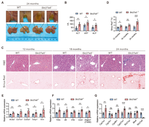 SLC27A5在肝纤维化进展中的作用机制