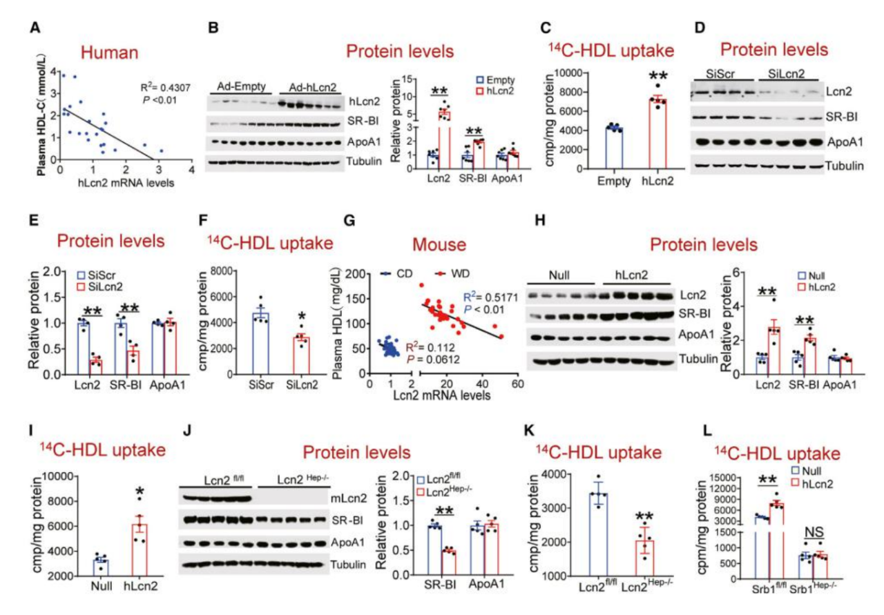 复旦大学徐延勇等团队发现动脉粥样硬化的关键调节因子 复旦大学徐延勇等团队发现动脉粥样硬化的关键调节因子