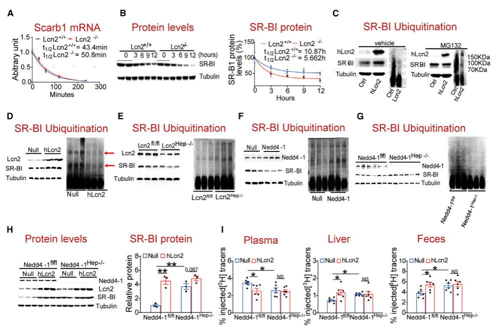 复旦大学徐延勇等团队发现动脉粥样硬化的关键调节因子 复旦大学徐延勇等团队发现动脉粥样硬化的关键调节因子