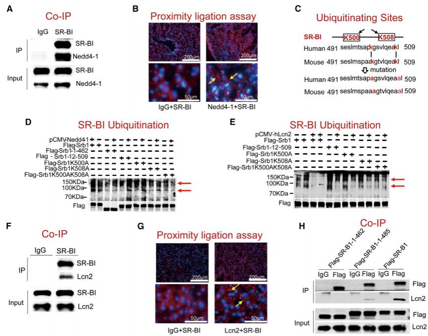 复旦大学徐延勇等团队发现动脉粥样硬化的关键调节因子 复旦大学徐延勇等团队发现动脉粥样硬化的关键调节因子