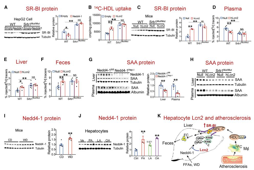 复旦大学徐延勇等团队发现动脉粥样硬化的关键调节因子 复旦大学徐延勇等团队发现动脉粥样硬化的关键调节因子