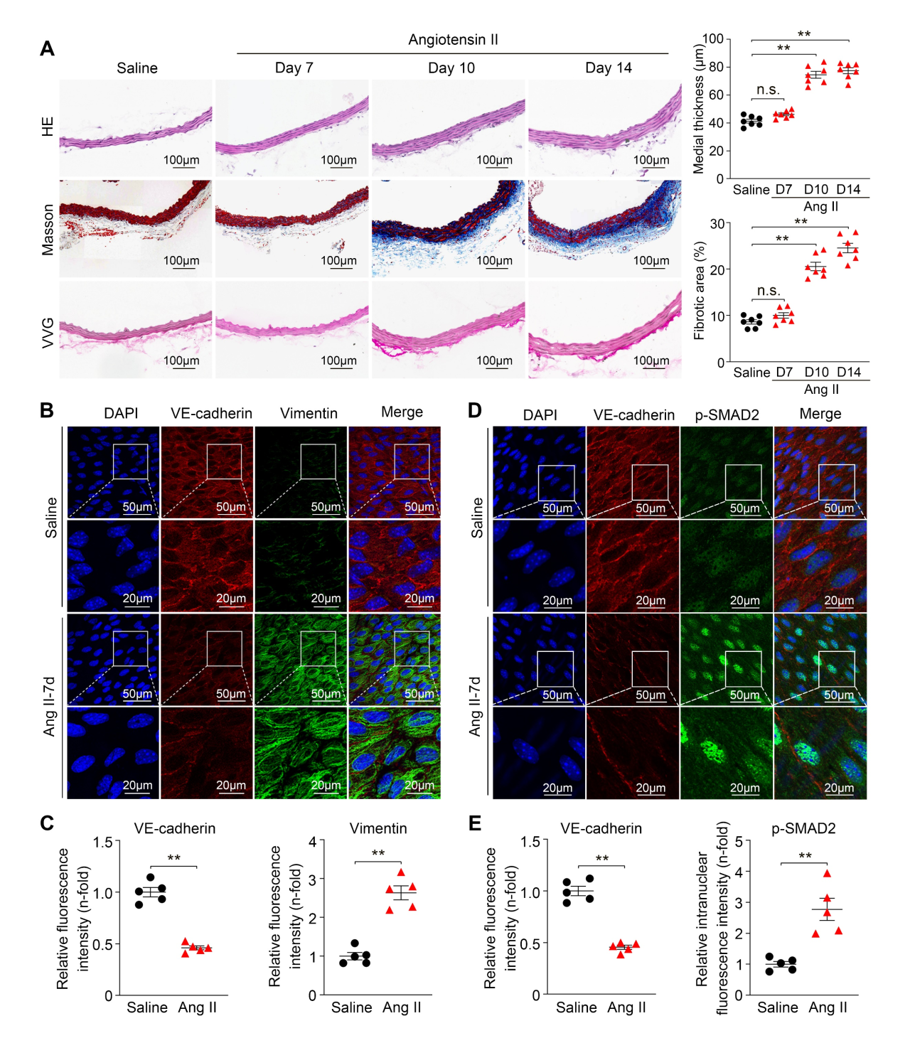 广州医科大学发现主动脉重构调控新机制