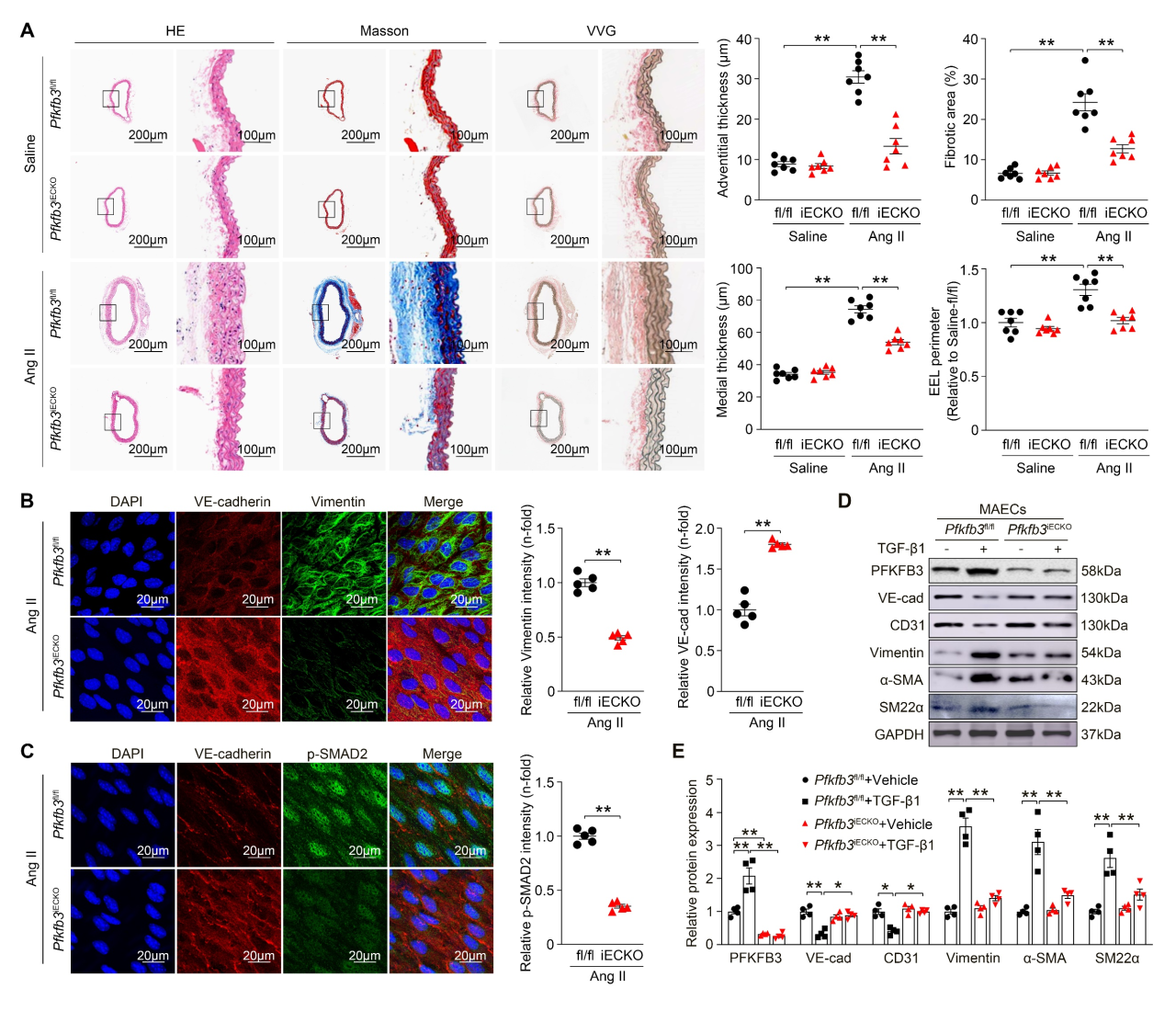 广州医科大学发现主动脉重构调控新机制
