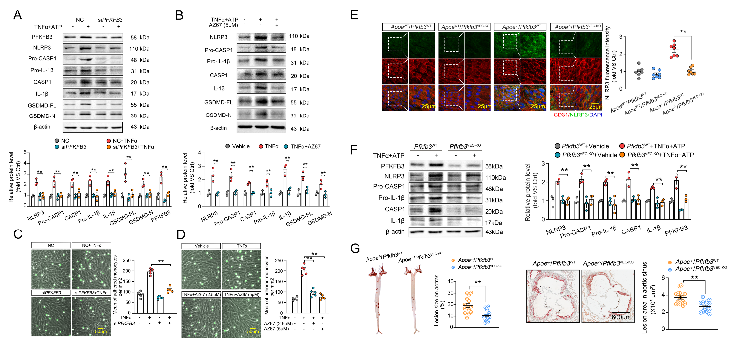 广州医科大学徐益鸣团队发现动脉粥样硬化调控新机制