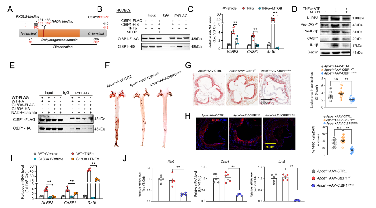 广州医科大学徐益鸣团队发现动脉粥样硬化调控新机制