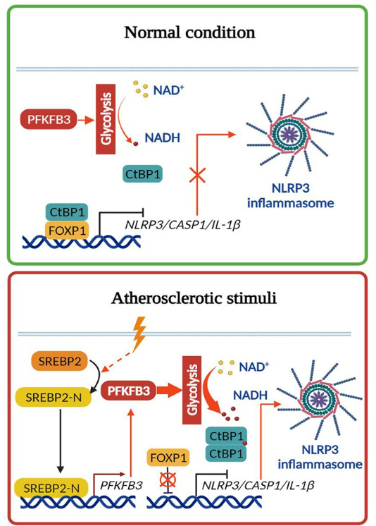 广州医科大学徐益鸣团队发现动脉粥样硬化调控新机制