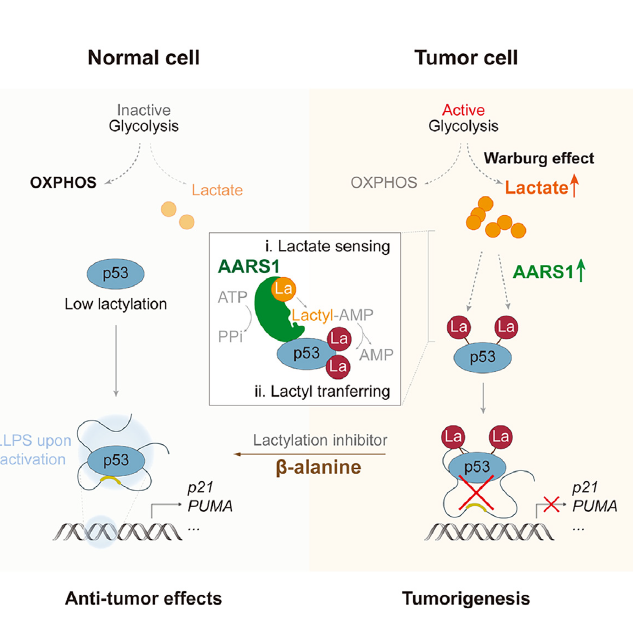 苏州大学团队揭示乳酸化如何促进肿瘤发生 苏州大学团队揭示乳酸化如何促进肿瘤发生