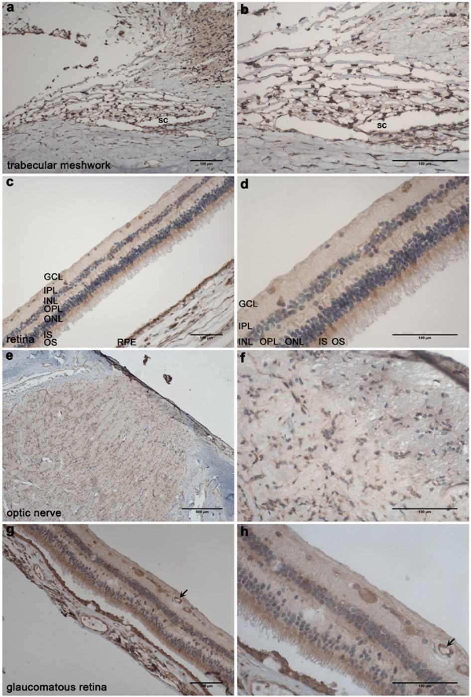 AFAP1蛋白在人体眼组织的分布