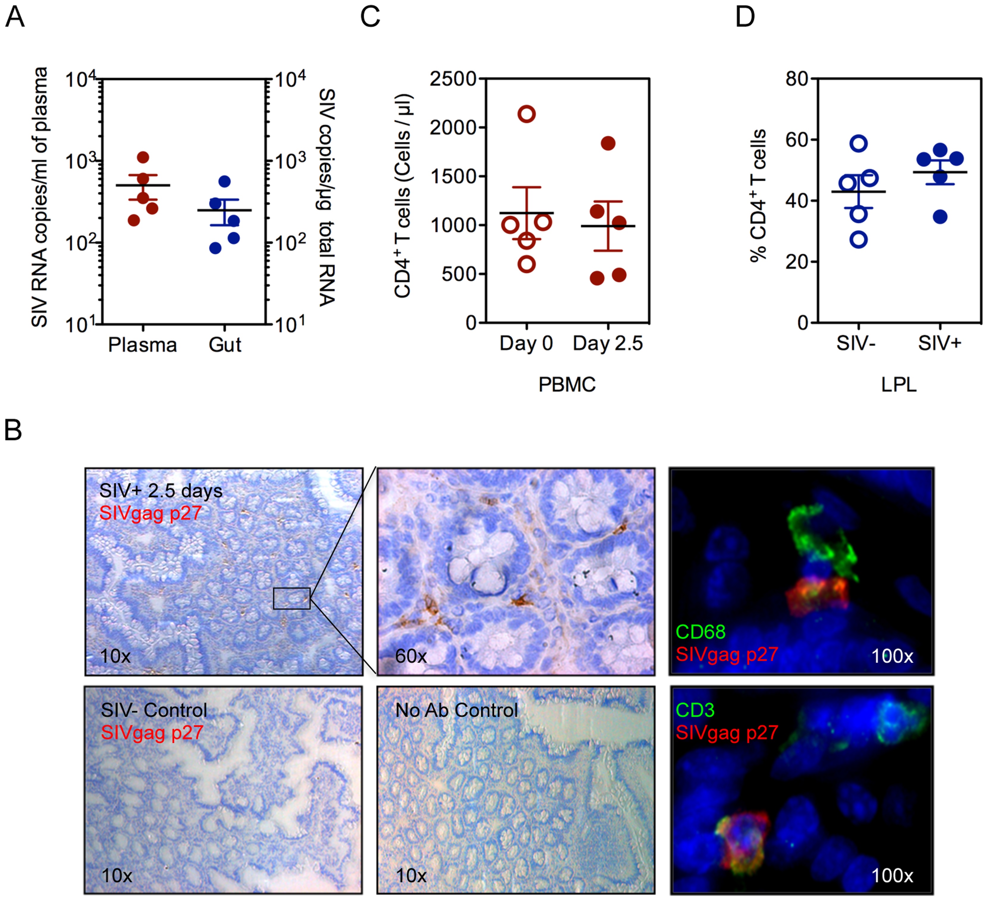 PLOS子刊:潘氏细胞在HIV感染初期产生IL-1β破坏免疫系统第一道屏障