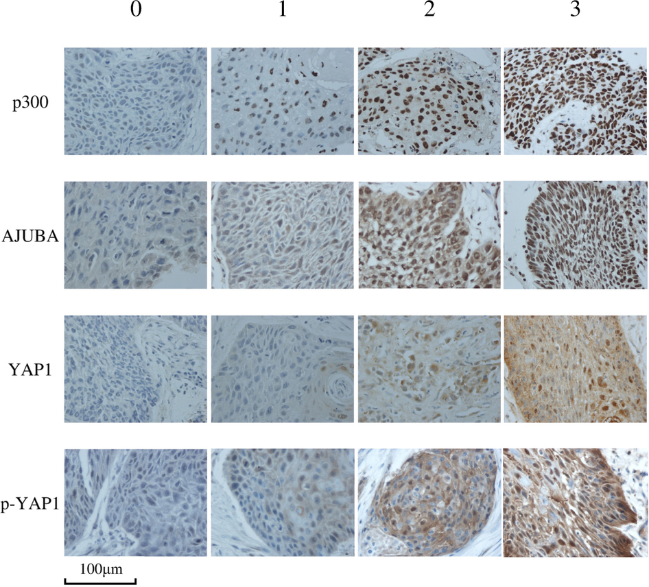 免疫组化代表性领域的结果