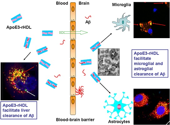 上海交大在阿尔兹海默病的治疗干预方面取得研究新进展
