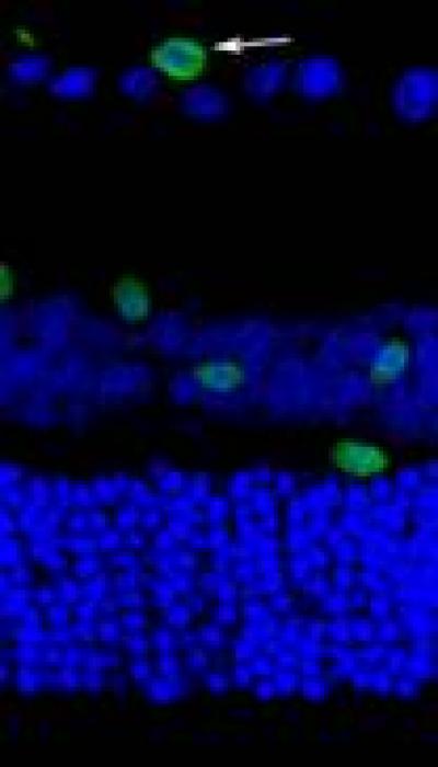 Nogo受体与糖尿病视网膜神经节细胞凋亡有关