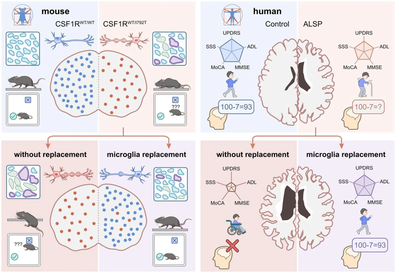 大脑免疫细胞也能通过骨髓移植“重装” 大脑免疫细胞也能通过骨髓移植“重装”